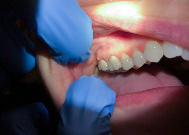 Best Pediatric Emergency Dentist in Belmont, VA