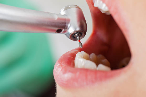 Best 24-Hour Emergency Dentist in Belmont, VA